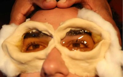 Eye Basti- Therapeutic Ayurvedic Treatment For The Eyes